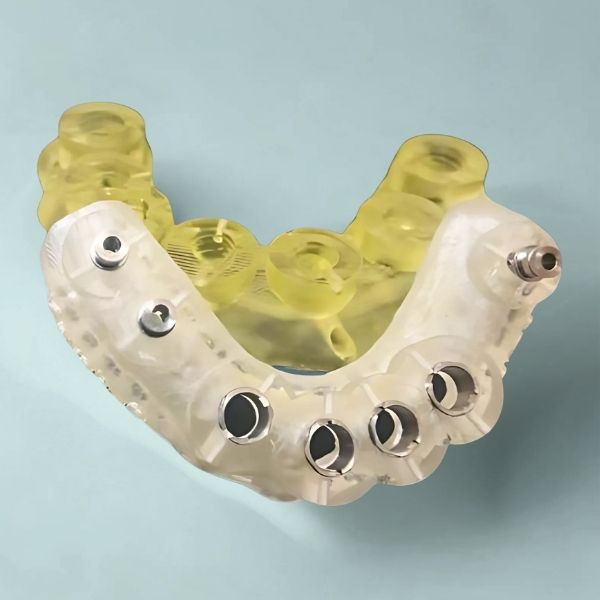 Bone-supported surgical guide (3)