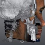 Processing of diagnostic data