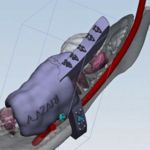 Creation of a surgical guide