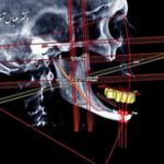 Personalized treatment plan creation Proguide